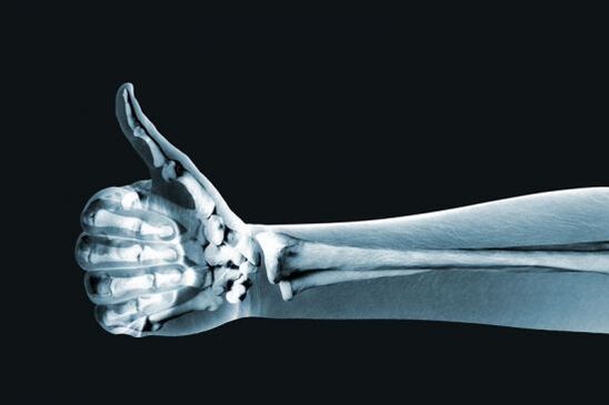 X-ray for the diagnosis of pain in the finger joints