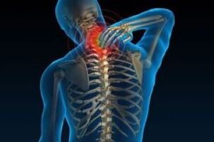 The cervical osteochondria leads to neck pain