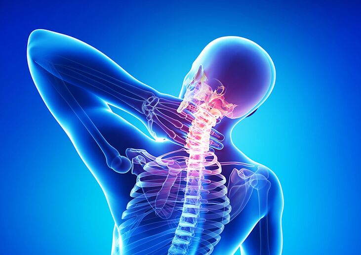 Vertebral osteochondrosis is a disease that affects the articular cartilage and vertebrae.